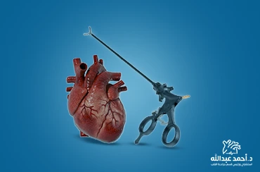 جراحة-القلب-بالمنظار